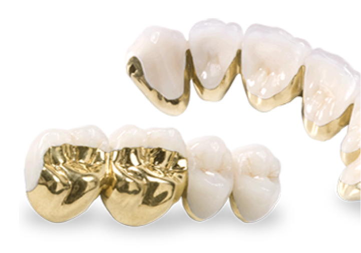 Dental Gold